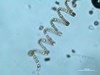 Photo of Chaetoceros debilis